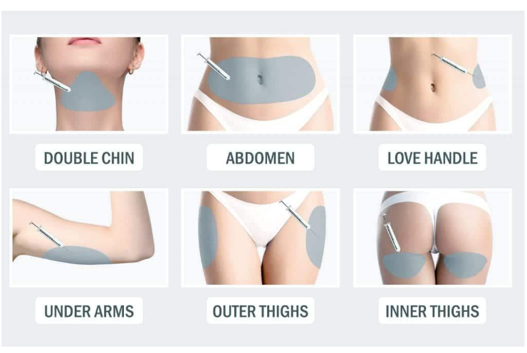 Localized Fat Reduction Injections