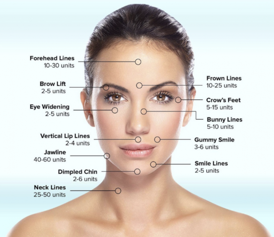Botox®/ Dysport®/ Xeomin®