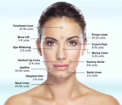 Botox®/ Dysport®/ Xeomin®